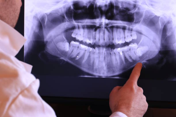 Best Urgent Care for Lost Fillings or Crowns in Mattawan, MI