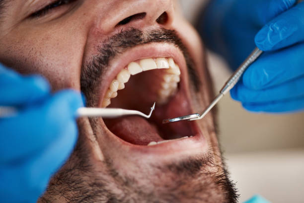 Best Emergency TMJ Treatment in Mattawan, MI